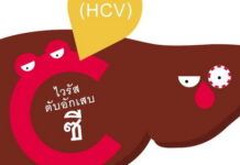 หยุดผูกขาดยารักษาไวรัสตับอักเสบซี!